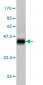 RPS6KB1 Antibody (monoclonal) (M02)